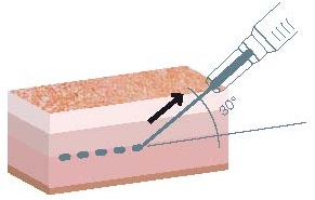 Chirurgia Plastica Frenello | Come prevenire o curare l’aging cutaneo