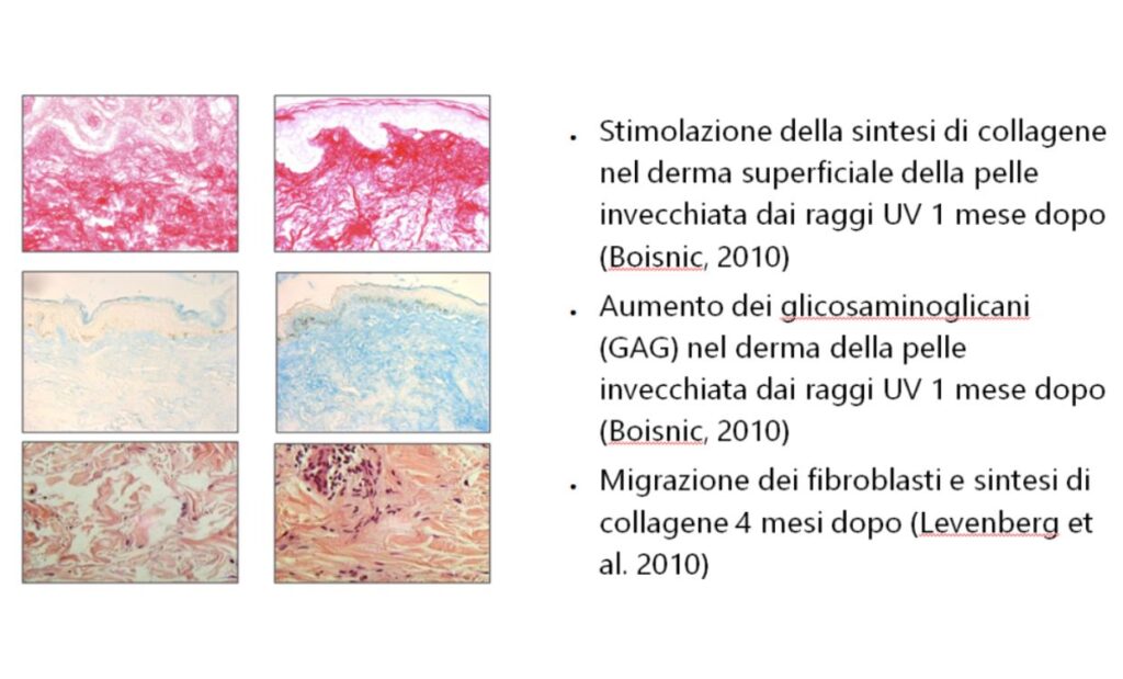 Chirurgia Plastica Frenello | Che cos’è Enerjet 2.0