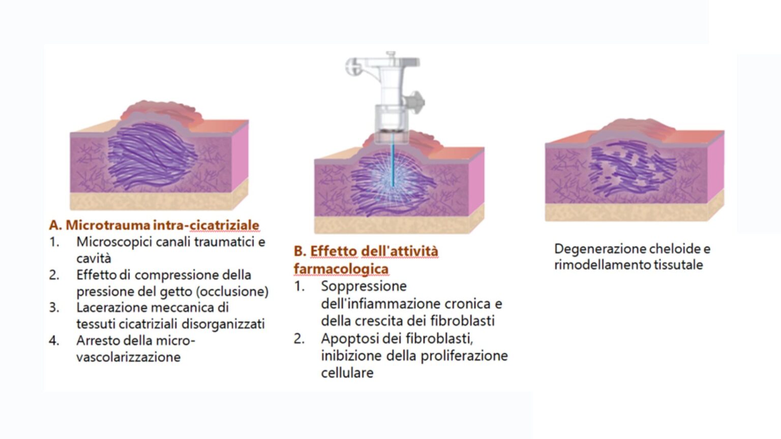 Chirurgia Plastica Frenello | Enerjet™ 2.0