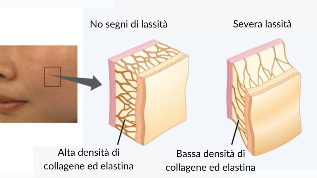 Chirurgia Plastica Frenello | Enerjet™ 2.0