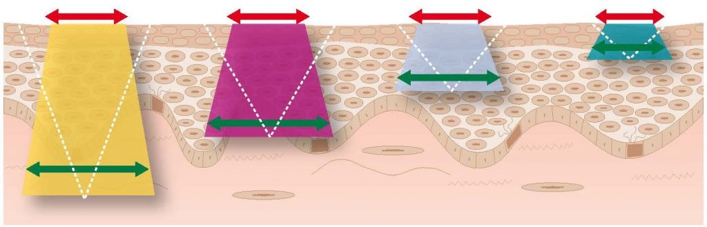 Chirurgia Plastica Frenello | In cosa consiste il peeling chimico e come realizzarlo: il sistema Enerpeel