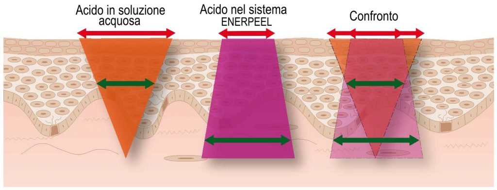 Chirurgia Plastica Frenello | In cosa consiste il peeling chimico e come realizzarlo: il sistema Enerpeel